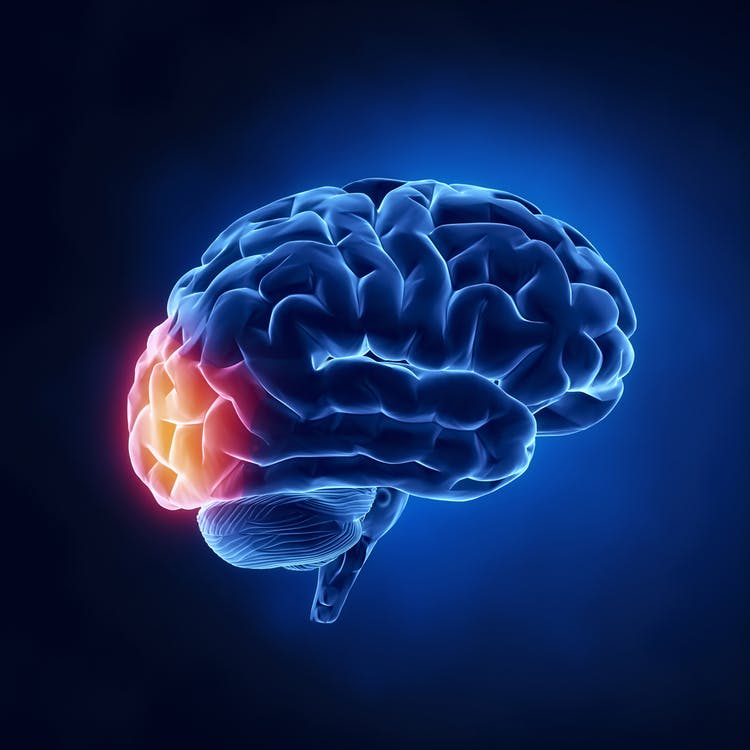 Ilustración de accidente cerebrovascular del lóbulo occipital en relación con el resto del cerebro