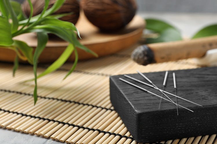 acupuncture cerebral palsy treatment