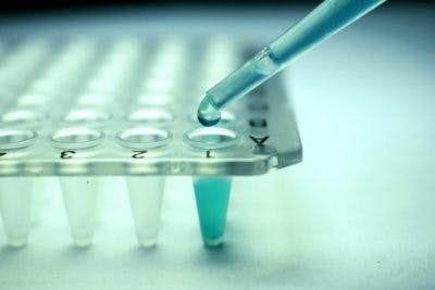syringe with stem cells for brain injury inside