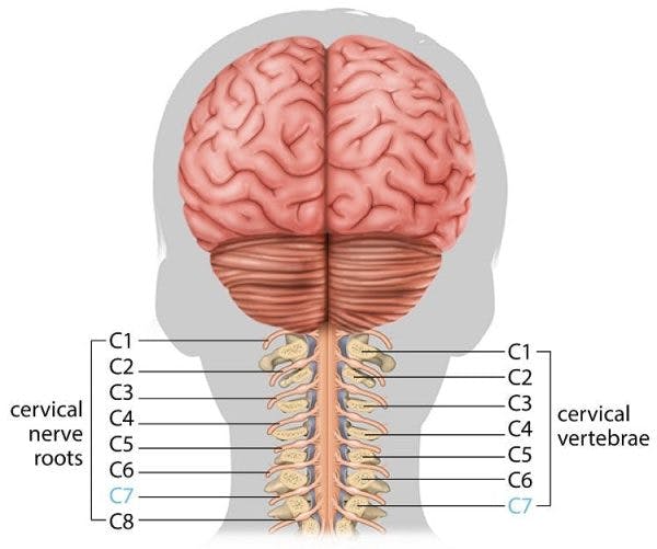 medical illustration of a c7 spinal cord injury