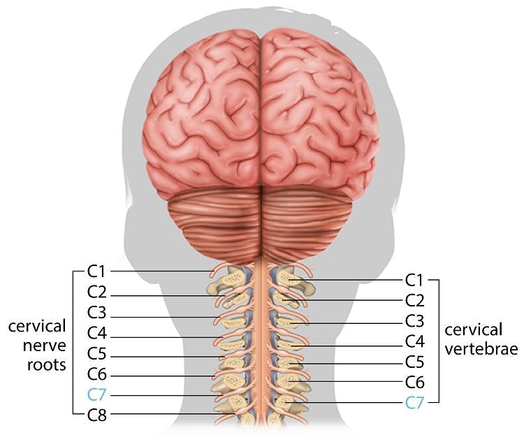 medical illustration of a c7 spinal cord injury