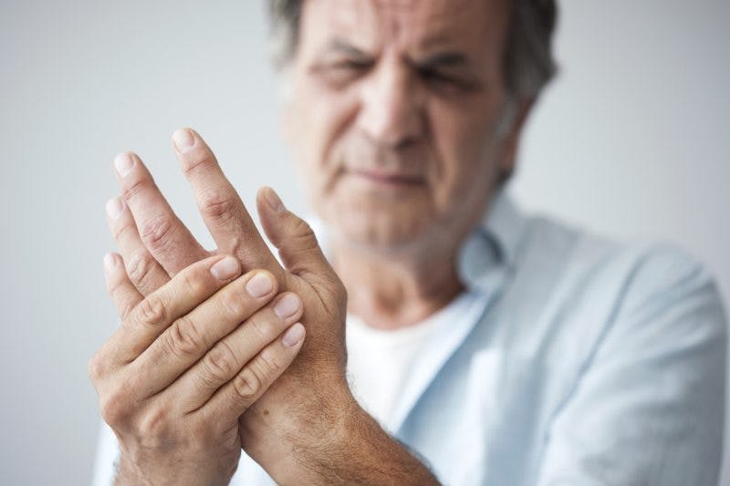 stroke patient with hand contractures