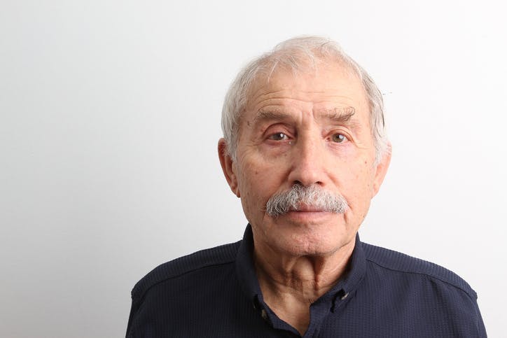 Un homme qui porte une expression plutôt placide, peut-être un peu vacant, symbolisant les effets d'un émoussement des émotions, qui sont courants chez les patients atteints d'un AVC qui touche les ganglions de la base.