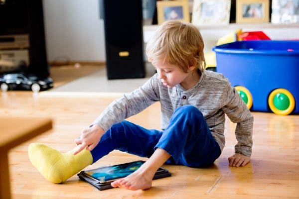 serial casting for cerebral palsy is a non-invasive form of spasticity management