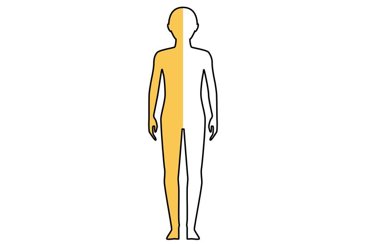 illustration of areas of the body affected by left hemiplegia