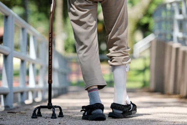man walking with foot drop brace and four-prong cane