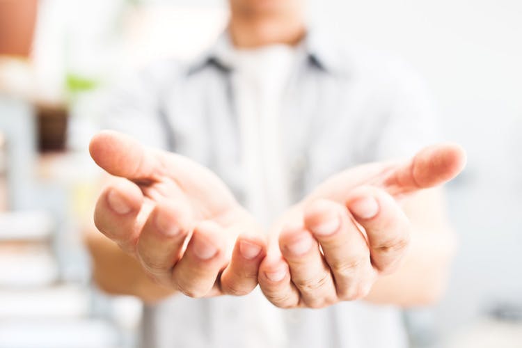 Stroke patient with relaxed, open hands after treating clenched hands