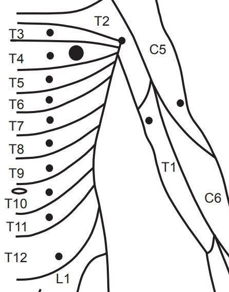 thoracic dermatomes