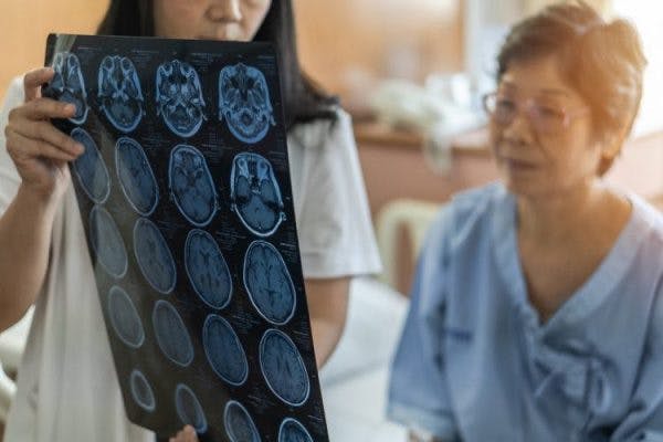 Doctor showing patient mri scan of her coup-contrecoup brain injuries