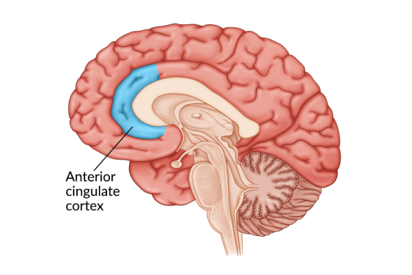 medical illustration of brain highlighting anterio cingulate cortex damage