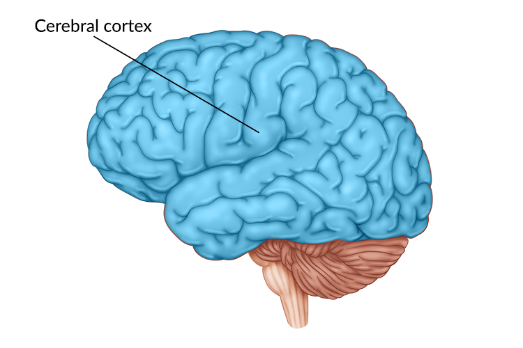 medical illustration of cerebral cortex damage in the brain