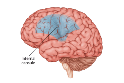 medical illustration of brain with the internal capsule highlighted
