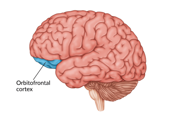 illustration of orbitofrontal cortex damage area in the brain