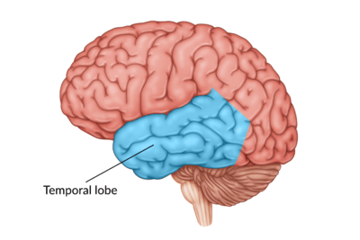 medical illustration of brain with the temporal lobe highlighted